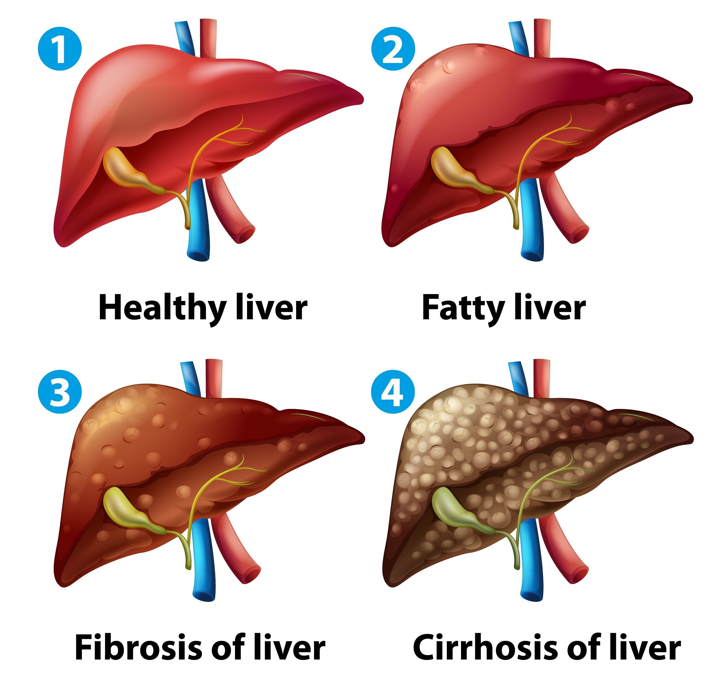 liver-5